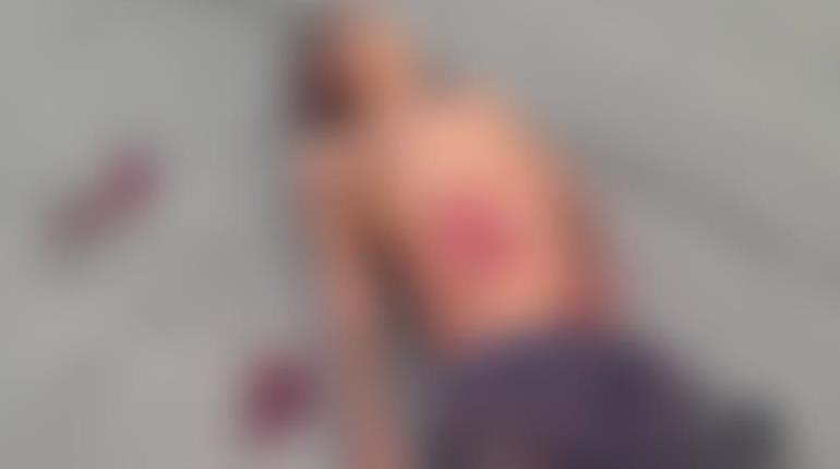 Atropellan a hombre en situación de calle en Periférico de Villahermosa