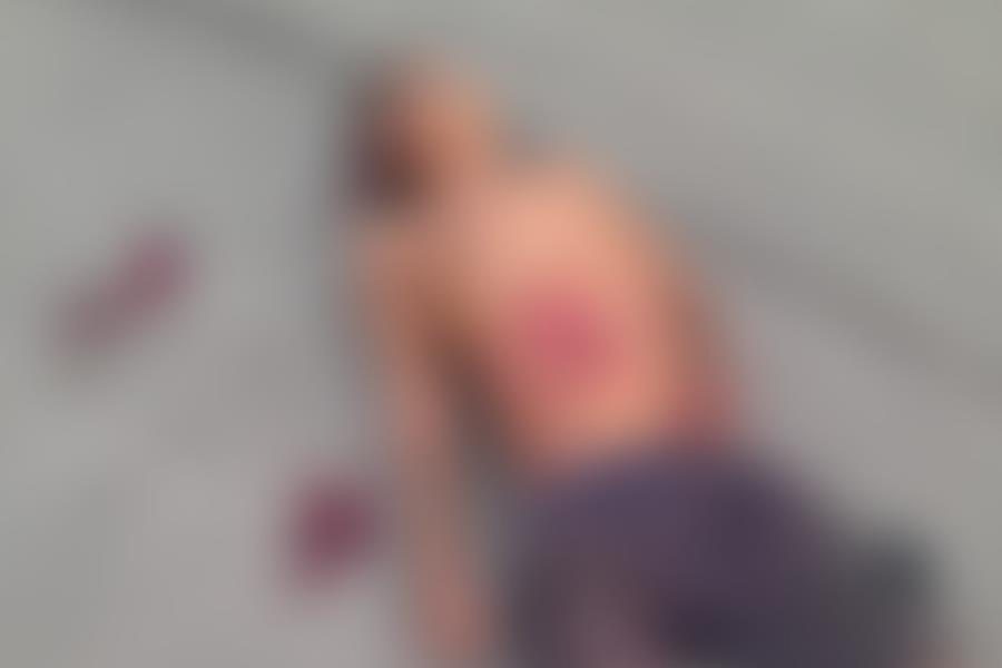 Atropellan a hombre en situación de calle en Periférico de Villahermosa Atropellan a hombre en situación de calle en Periférico de Villahermosa