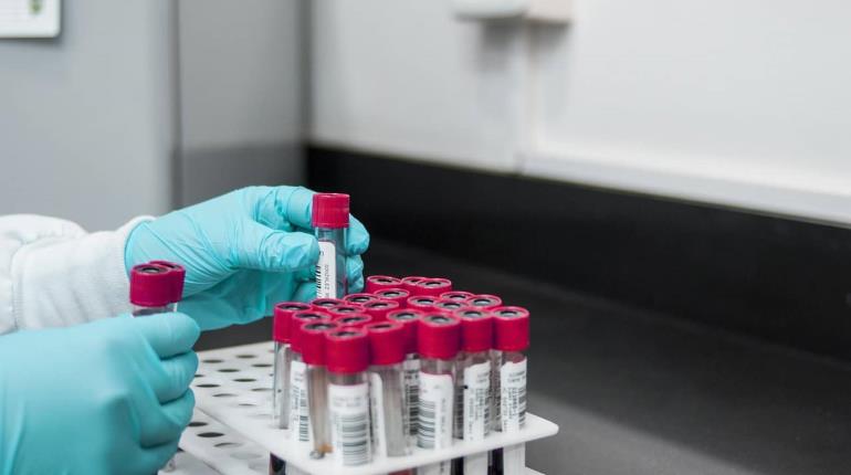 Sigue Tabasco sin casos de gusano barrenador en humanos: Salud