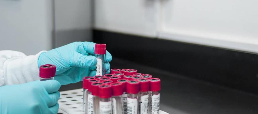 Sigue Tabasco sin casos de gusano barrenador en humanos: Salud Sigue Tabasco sin casos de gusano barrenador en humanos: Salud