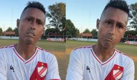 Diagnostican a Osvaldo Martínez con inicios de esclerodermia