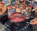Apuñalan a franelero en CDMX; espera ambulancia fumando y con intestinos expuestos