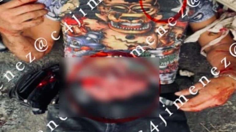 Apuñalan a franelero en CDMX; espera ambulancia fumando y con intestinos expuestos
