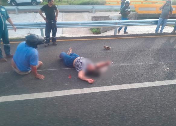 Mujer sufre lesiones tras derrapar en motocicleta en la Cunduacán-La Isla Mujer sufre lesiones tras derrapar en motocicleta en la Cunduacán-La Isla