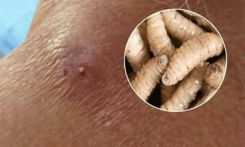 En Tabasco se han registrado 2 casos de gusano barrenador en humanos, pero ya están curados: Salud