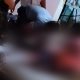 Riña en Gaviotas Sur termina con un lesionado de gravedad por palazo en la cabeza