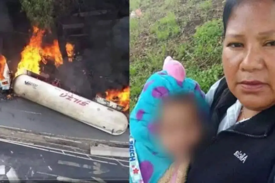 Jazlyn, menor sobreviviente a explosión de pipa en Iztapalapa, recibe primera cirugía de injertos
