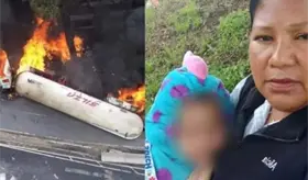 Jazlyn, menor sobreviviente a explosión de pipa en Iztapalapa, recibe primera cirugía de injertos