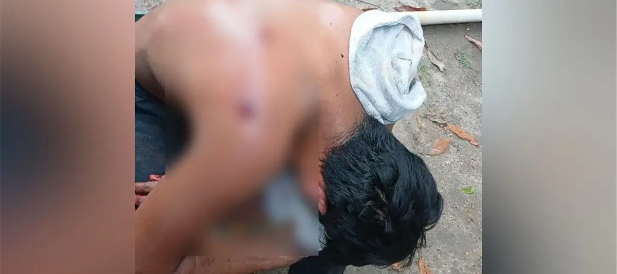 Sujeto resulta herido de bala en Comalcalco
