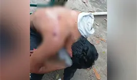 Sujeto resulta herido de bala en Comalcalco