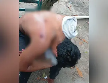 Sujeto resulta herido de bala en Comalcalco