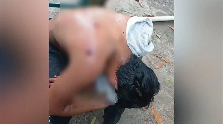 Sujeto resulta herido de bala en Comalcalco