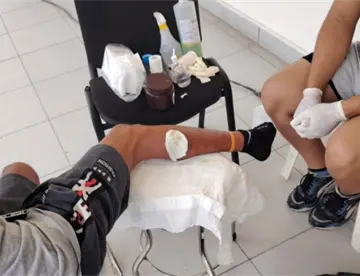 Migrante cubano infectado por gusano barrenador pide ayuda a Sheinbaum para llegar a CDMX