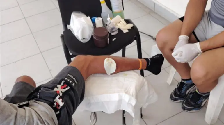 Migrante cubano infectado por gusano barrenador pide ayuda a Sheinbaum para llegar a CDMX