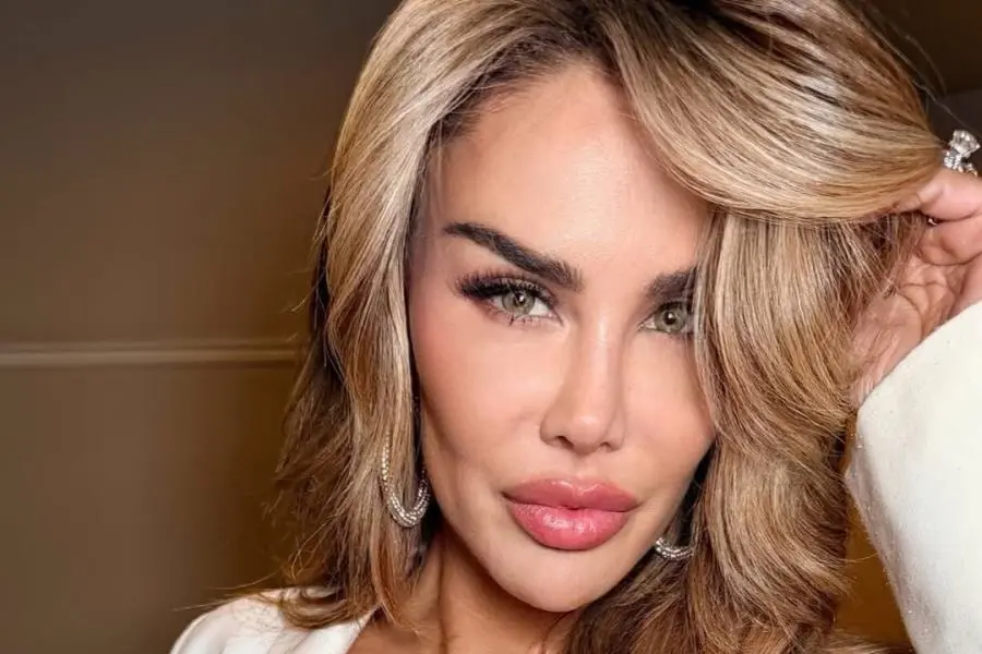 Ninel Conde se vuelve ojiverde, se somete a cirugía