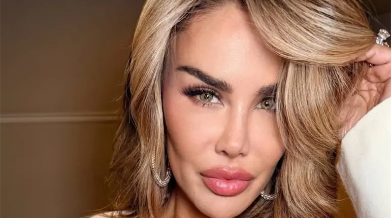 Ninel Conde se vuelve ojiverde, se somete a cirugía