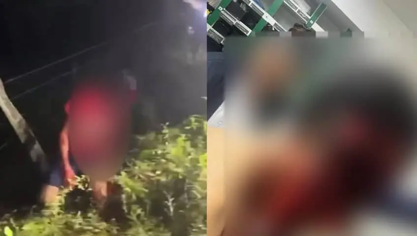 Se desfigura el rostro tras derrapar con su motocicleta en la Ceiba, Jalpa
