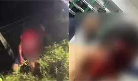 Se desfigura el rostro tras derrapar con su motocicleta en la Ceiba, Jalpa