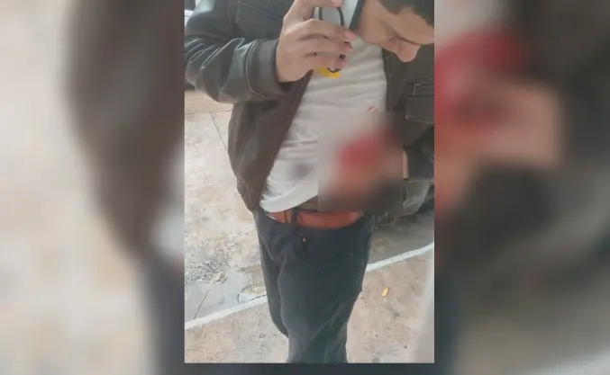 Atacan a 2 hombres en Comalcalco con armas blancas