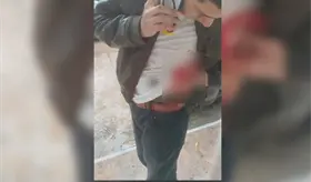 Atacan a 2 hombres en Comalcalco con armas blancas