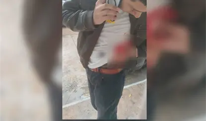 Atacan a 2 hombres en Comalcalco con armas blancas