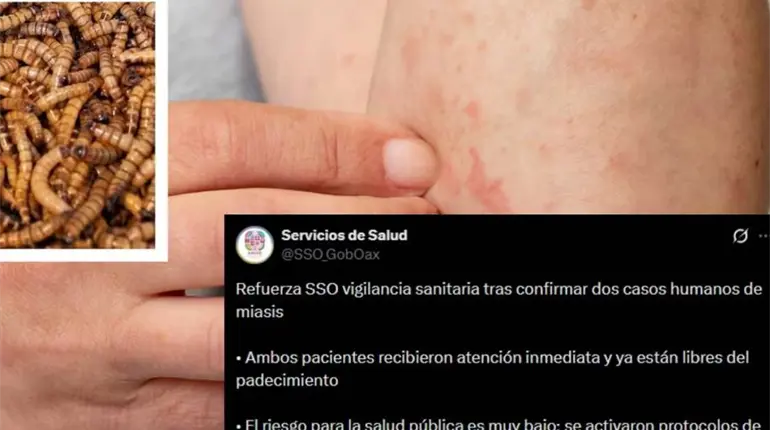 Confirman primeros casos de gusano barrenador en humanos, en Oaxaca