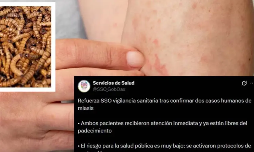 Confirman primeros casos de gusano barrenador en humanos, en Oaxaca