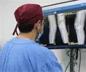IMSS incorpora cirugía robótica para reemplazo de rodilla que reduce sangrado, dolor y tiempo de recuperación IMSS incorpora cirugía robótica para reemplazo de rodilla que reduce sangrado, dolor y tiempo de recuperación
