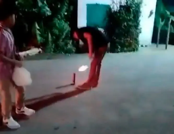 Joven pierde un ojo tras explotarle un tronador en Centla