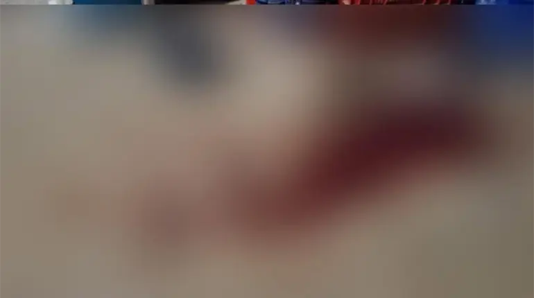 Asaltan y golpean a trabajador de gasera en Nacajuca