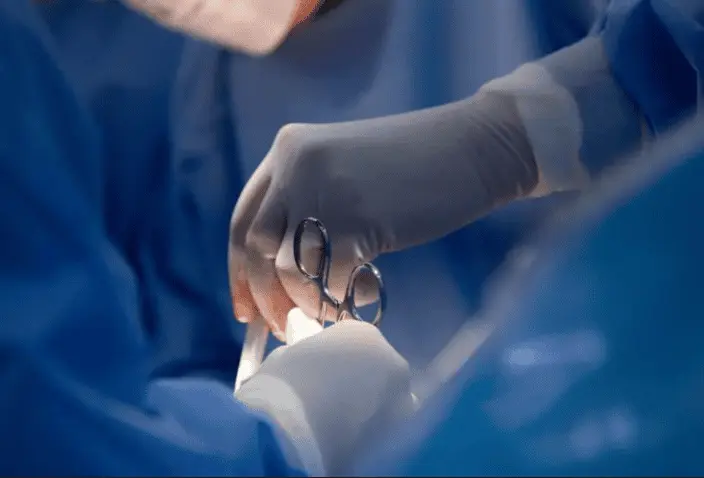 Le extirpan tumor de m&aacute;s de 60 kilos en Rusia; vivi&oacute; con &eacute;l 20 a&ntilde;os