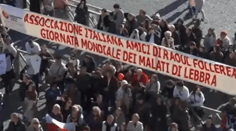 Expresa Papa cercan&iacute;a con enfermos de lepra