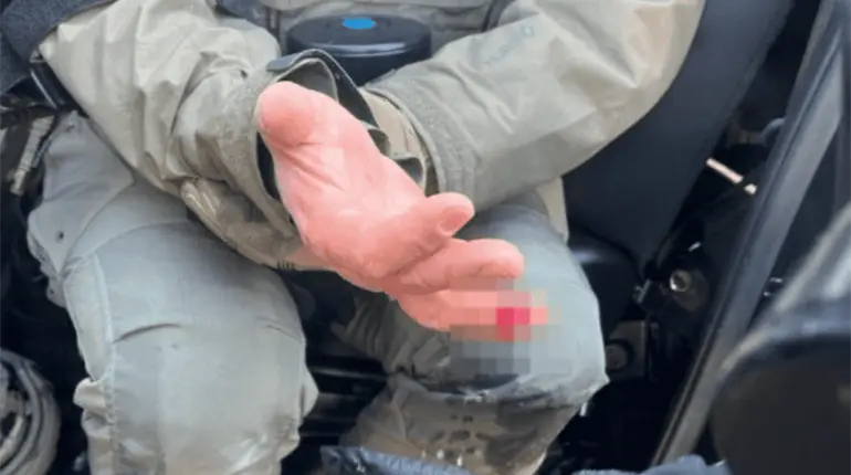 Manifestante arranca de una mordida dedo a agente en Minneapolis: Fiscal de EE. UU.