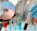 Se registra primera muerte por virus Shamonda en Francia