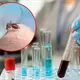 Se registra primera muerte por virus Shamonda en Francia