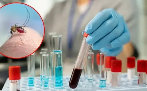 Se registra primera muerte por virus Shamonda en Francia